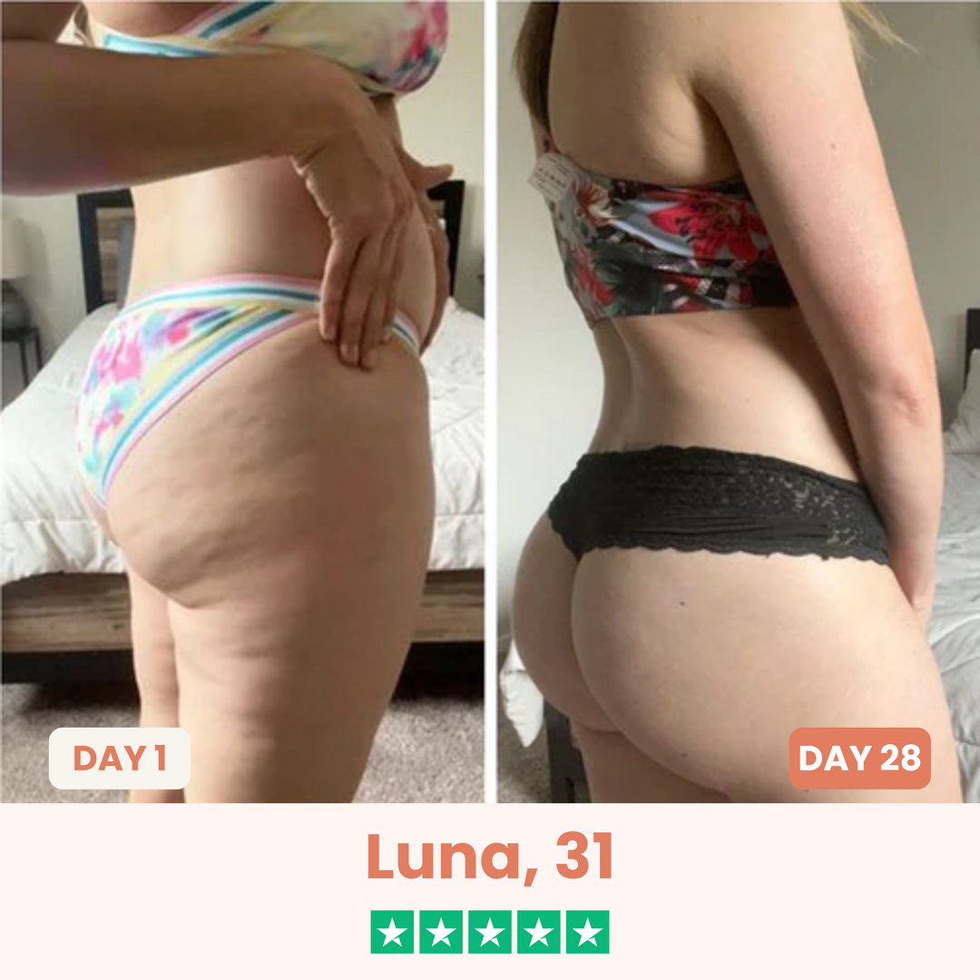 The Cellōa Lift : Say goodbye to your cellulite now
