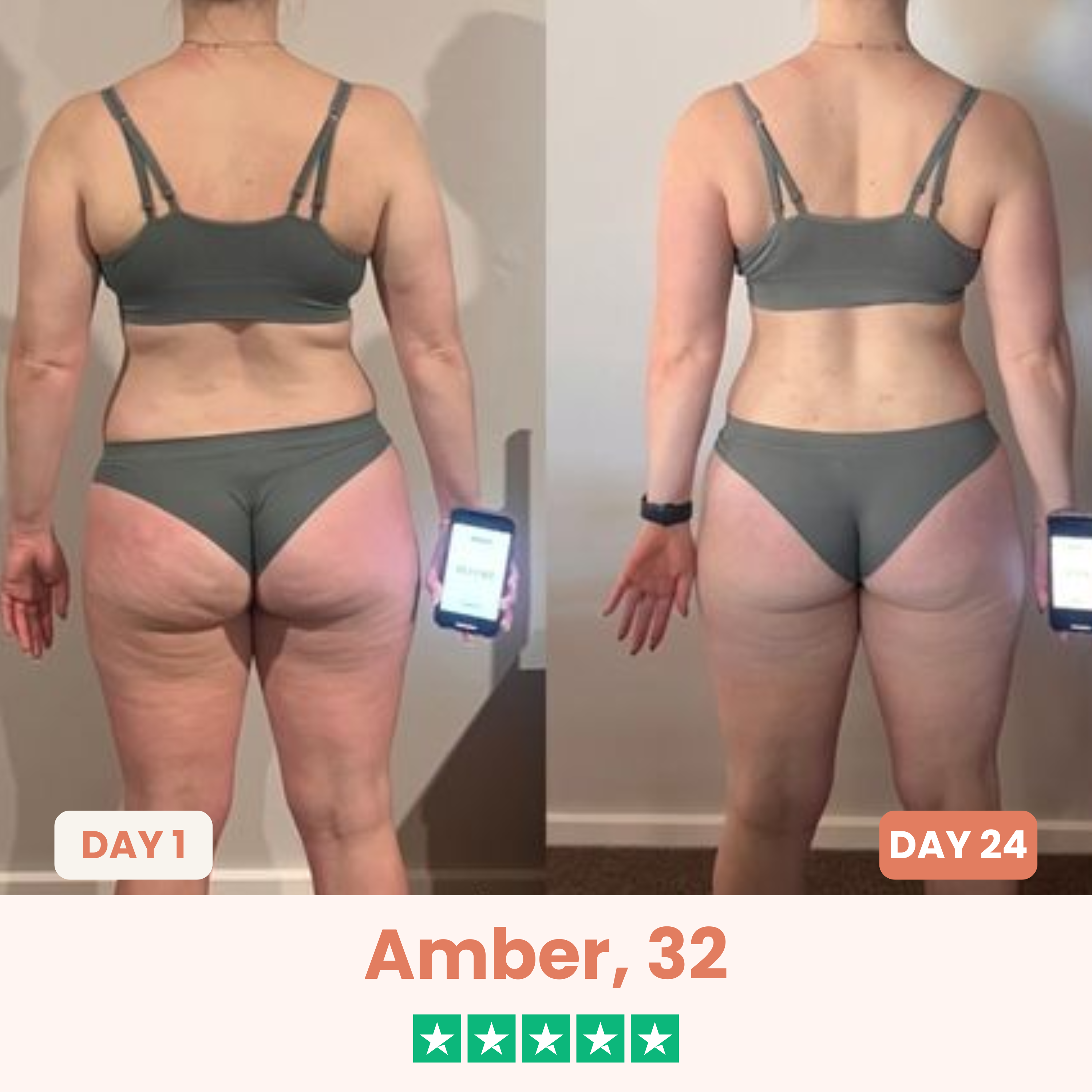 The Cellōa Lift : Say goodbye to your cellulite now