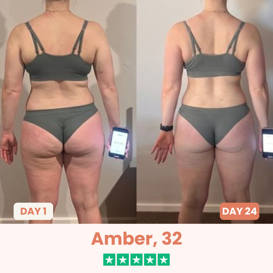 The Cellōa Lift : Say goodbye to your cellulite now